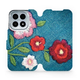 Phone Case Xiaomi 17 - Design MD05P