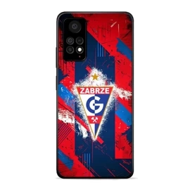 Hülle Glossy Case für Xiaomi Redmi Note 11 Pro 5G - Farbe G02GZ