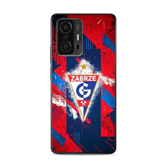 Etui Glossy Case do Xiaomi 11T Pro - wzór G02GZ