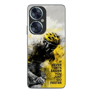 Hülle Glossy Case für Huawei Nova 11i - Farbe GD11G