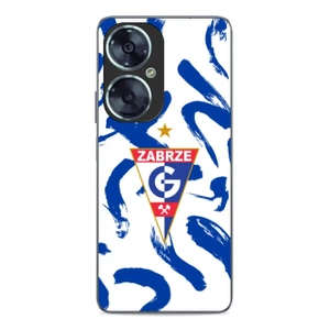 Hülle Glossy Case für Huawei Nova 11i - Farbe G05GZ