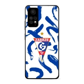 Hülle Glossy Case für Xiaomi Redmi Note 11 Pro 5G - Farbe G05GZ