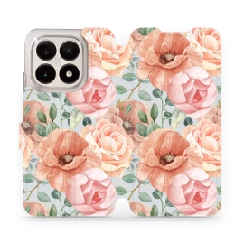 Phone Case Xiaomi 15T - Design MP02S