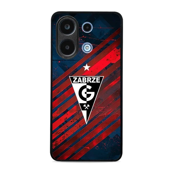 Hülle Glossy Case für Xiaomi Redmi Note 13 4G - Farbe G04GZ