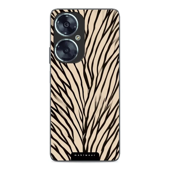 Hülle Glossy Case für Huawei Nova 11i - Farbe GA52G