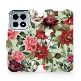 Phone Case Xiaomi 17 - Design MD06P