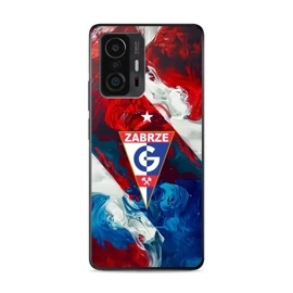 Hülle Glossy Case für Xiaomi 11T Pro - Farbe G01GZ