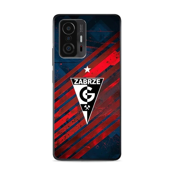 Etui Glossy Case do Xiaomi 11T Pro - wzór G04GZ