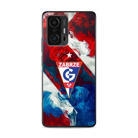 Etui Glossy Case do Xiaomi 11T Pro - wzór G01GZ