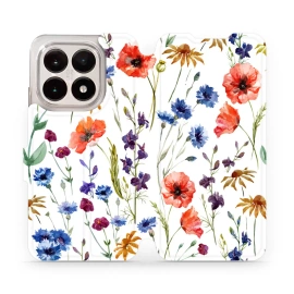 Phone Case Xiaomi 15T - Design MP04S