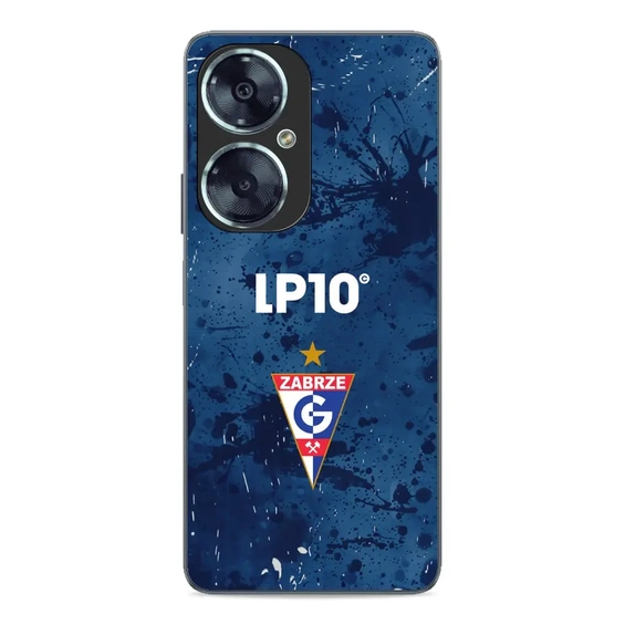 Etui Glossy Case do Huawei Nova 11i - wzór G12GZ