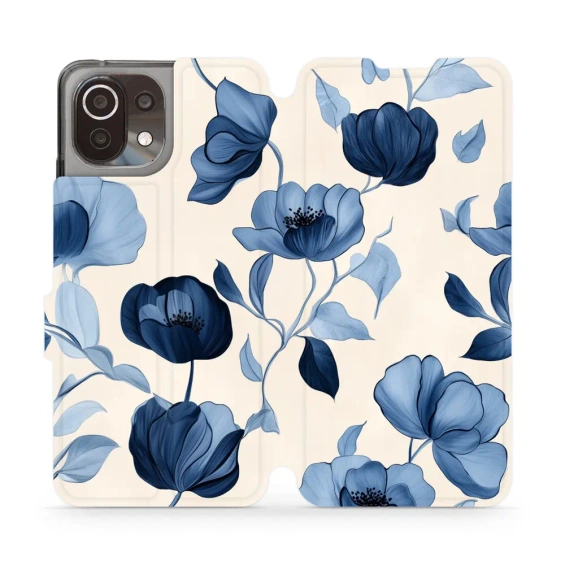 Hülle für Xiaomi 11 Lite 5G NE - Farbe VP73S