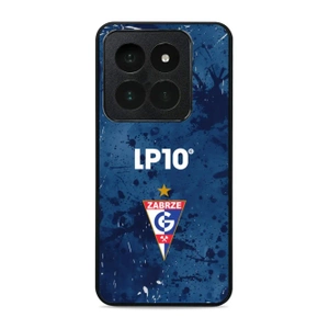 Hülle Glossy Case für Xiaomi 14 Pro - Farbe G12GZ