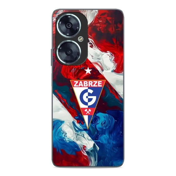 Hülle Glossy Case für Huawei Nova 11i - Farbe G01GZ