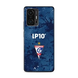 Hülle Glossy Case für Xiaomi 11T - Farbe G12GZ