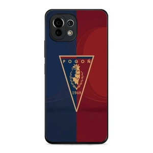 Etui Glossy Case do Xiaomi Mi 11 Lite - wzór G08PS