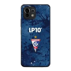 Hülle Glossy Case für Xiaomi 11 Lite 5G NE - Farbe G12GZ