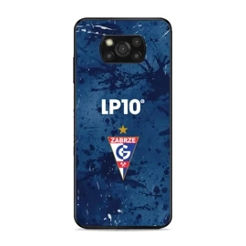 Hülle Glossy Case für Xiaomi POCO X3 NFC - Farbe G12GZ